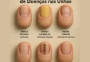 Doenças das unhas