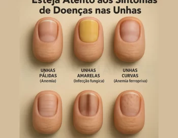 Doenças das unhas